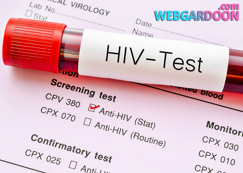آزمایش HIV چیست؟