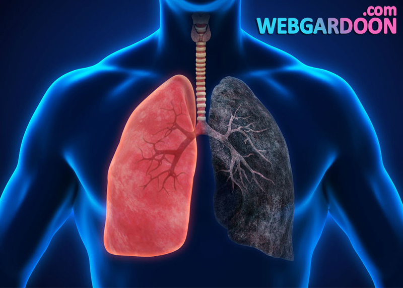 درمان سرطان ریه,وبگردون,مجله اینترنتی وبگردون,webgardoon